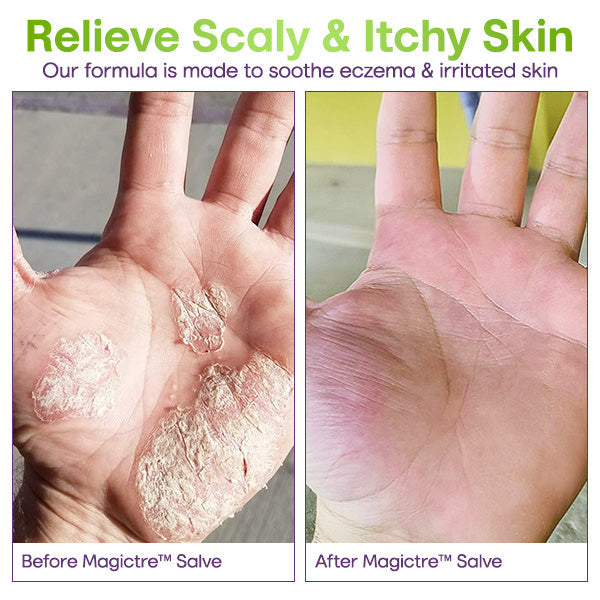 Magictre™ Ultimate Skin Solution Salve