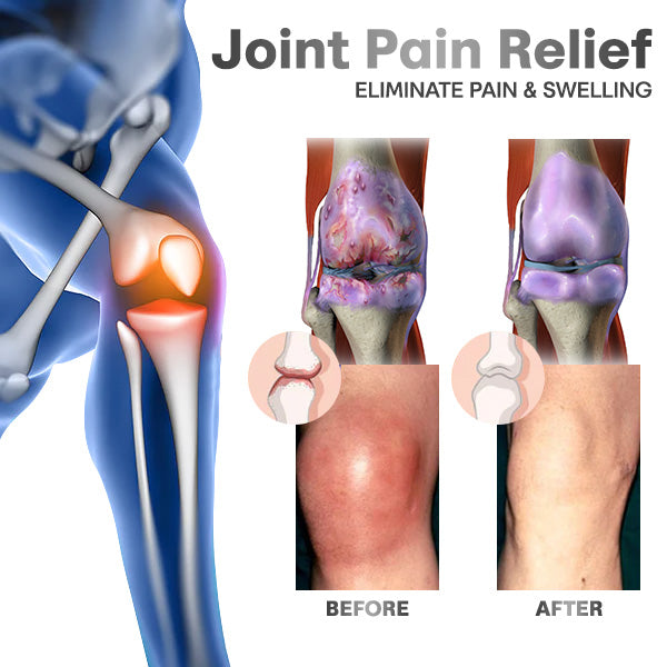 OsteoFlexify™ DualAction Bone & Joint Healing Cream